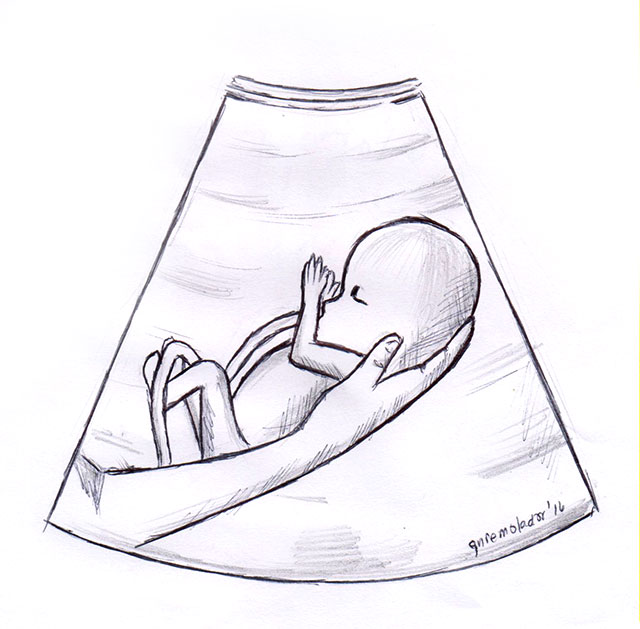 Care for Life